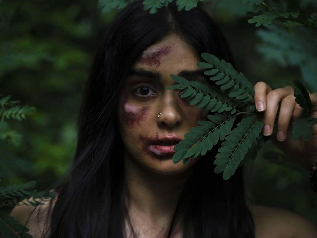 Adah Sharma bruised and bloodied